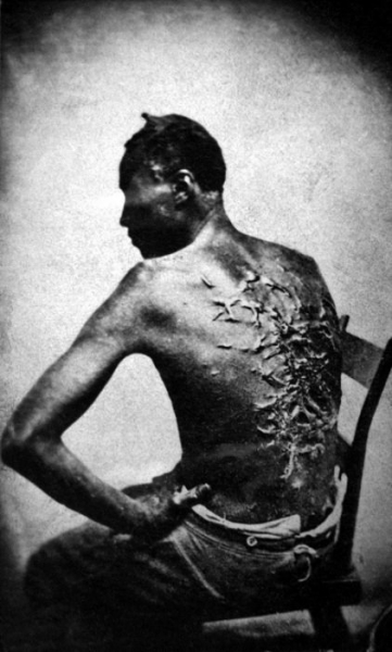Бывший раб показывает свои шрамы, Луизиана, США, 1863 год.

Больше..0