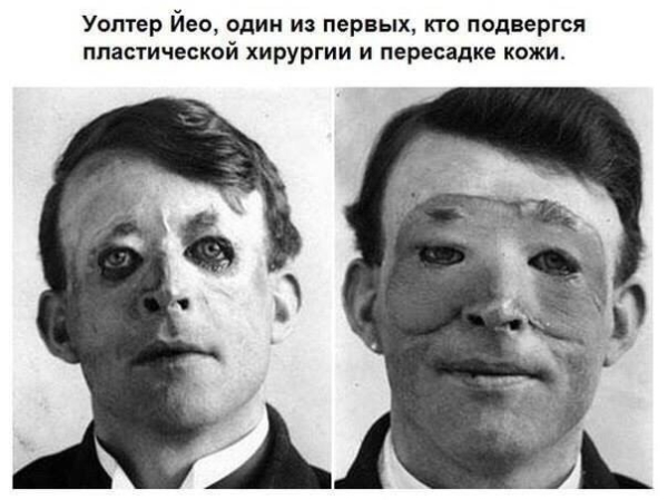 Фото-подборка с интересными и шокирующими фактами...

Больше..2