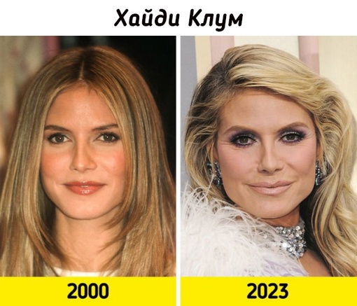 Супермодели на пике карьеры и в наши..7