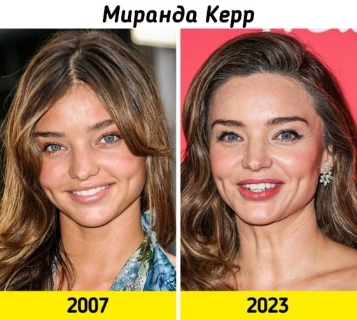 Супермодели на пике карьеры и в наши..9