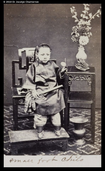 Китайские каноны красоты - стопа-копытце. Китай. 1890-е.

Больше..0