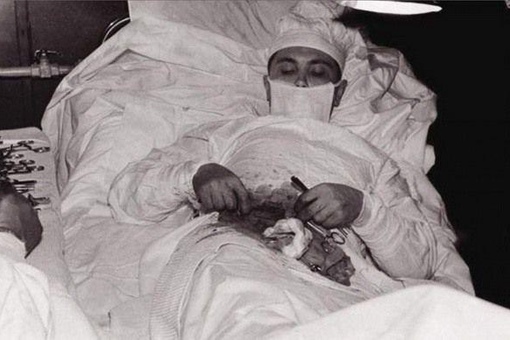 Советский врач вырезает себе аппендицит во время антарктической..0