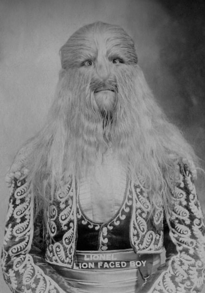 Стефан Бибровский — немецкий цирковой артист польского..0