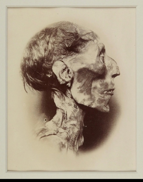 Голова мумии 90-летнего египетского фараона Рамзеса II , 1881 г . 

Жил..0