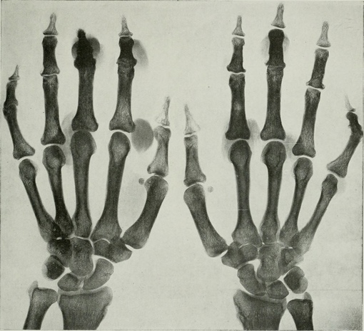 Из американского журнала рентгенологии, радиотерапии и ядерной..6