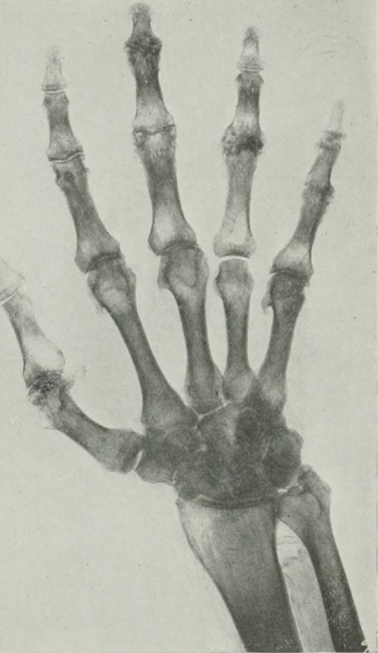 Из американского журнала рентгенологии, радиотерапии и ядерной..2