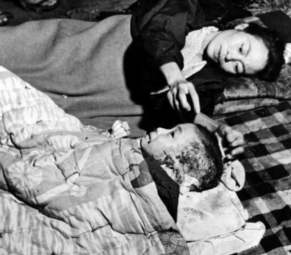 Мать Ухаживает за Ребенком, Пострадавшим от Взрыва Атомной..0