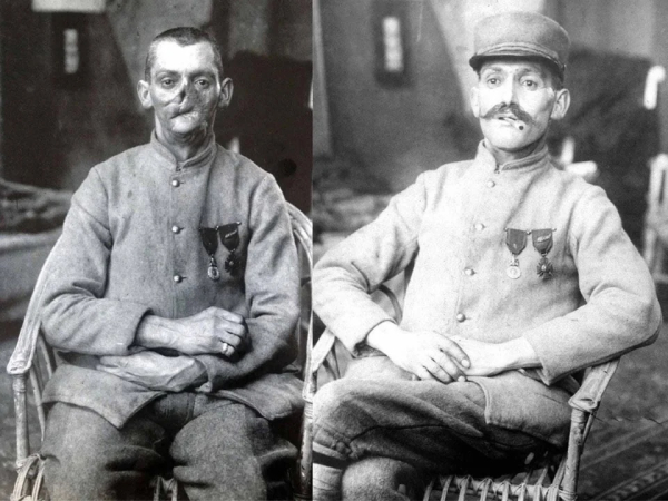 Анна Коулман Лэдд создала протезные маски для солдат,..2