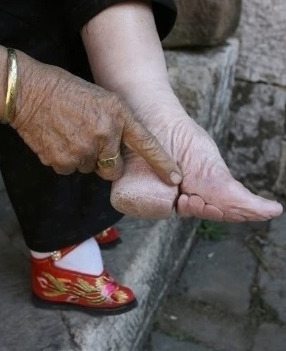 Бинтование ног: жестокий путь к 