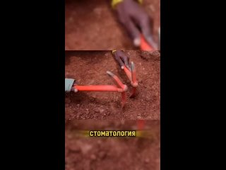 Мать удаляет больной зуб своему сыну, 1897..1