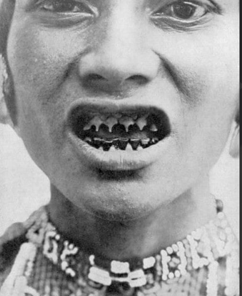 Заточка зубов у племен Индонезии и её последствия: фотографии 1938..1