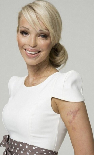 История Элеоноры Кондратюк — это невероятно трагический и..1