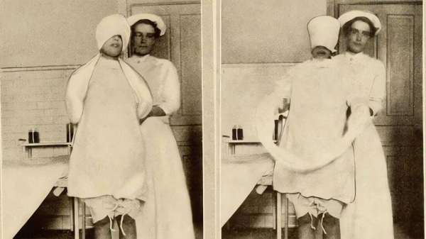 Подготовка к родам с помощью «сумеречного сна». Германия, 1910-е..0