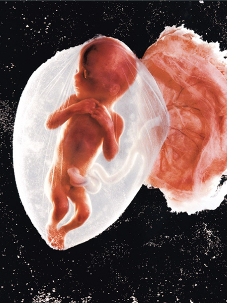 Зародыш, 18 недель — взгляд внутрь начала жизни
Fetus, 18 Weeks, 1965..0